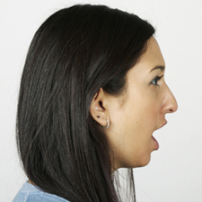 nonhi-back-nonround profile