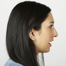 nonhi-front-nonround profile