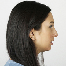 hi-back-nonround profile