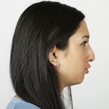 hi-front-round profile